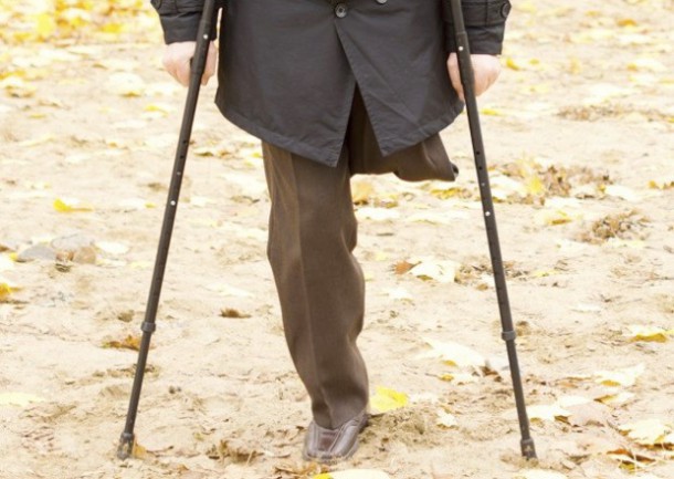 Ухтинец без ноги оспаривает присвоенную ему третью группу инвалидности